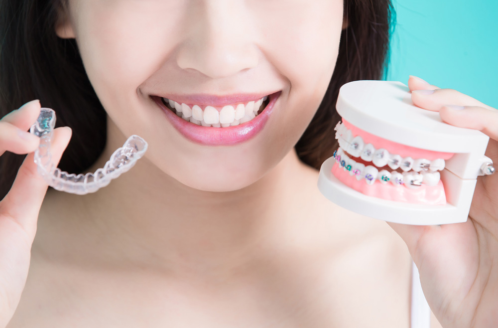 Why Clear Aligners Are a Great Alternative to Traditional Braces