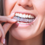 How to Choose the Right Clear Aligner Treatment Plan for Your Smile